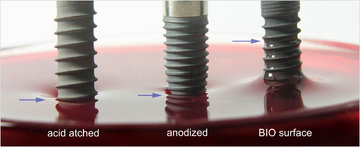 Comparation of dental implant surfaces