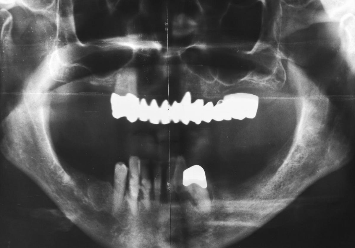 Baseline radiological findings